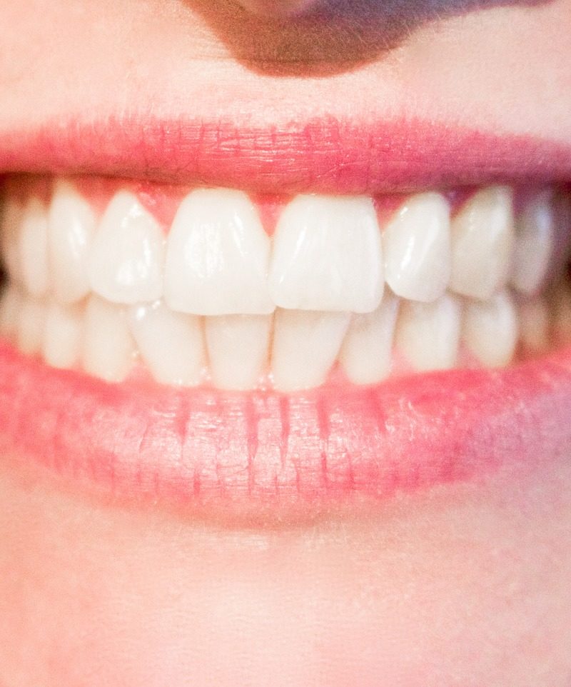 Nowoczesna technika wykorzystywana w salonach stomatologii estetycznej być może spowodować, że odbierzemy śliczny uśmieszek.